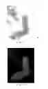 Fig. 09 - STEREOSCOPIC VOLUME RENDERING IMAGING SYSTEM