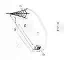 Fig. 10 - Radio base station and user equipment and methods therein