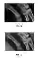 Fig. 04 - Imaging system