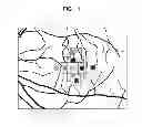 Fig. 12 - Image processing apparatus and image processing method