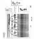 Fig. 07 - Generating image-based diagnostic tests by optimizing image analysis and data mining of co-registered images