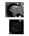 Fig. 02 - Axially varying truncation completion for MR-based attenuation correction for PET/MR
