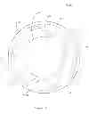 Fig. 09 - Bearing assembly for a drilling tool