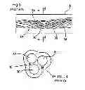 Fig. 04 - Apparatus and method for treating a mesh pocket of a lacrosse stick