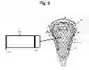 Fig. 06 - Apparatus and method for treating a mesh pocket of a lacrosse stick