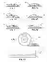 Fig. 02 - Apparatuses, systems and methods for selectively affecting movement of a motor vehicle