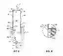 Fig. 05 - Bushing assembly