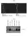 Fig. 04 - IMMUNOGLOBULIN-BOUND EXTRACELLULAR VESICLES AND USES THEREOF