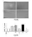 Fig. 08 - COMPOSITIONS AND METHODS FOR TREATING OCULAR DISEASES AND CONDITIONS