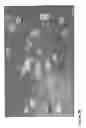 Fig. 07 - Phosphorylcholine conjugates and corresponding antibodies