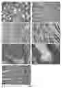 Fig. 03 - Method for predicting the risk of developing a colonic neoplasia