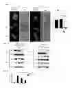 Fig. 06 - COMPOSITIONS TARGETING PKC-THETA AND USES AND METHODS OF TREATING PKC-THETA PATHOLOGIES, ADVERSE IMMUNE RESPONSES AND DISEASES