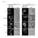 Fig. 08 - COMPOSITIONS TARGETING PKC-THETA AND USES AND METHODS OF TREATING PKC-THETA PATHOLOGIES, ADVERSE IMMUNE RESPONSES AND DISEASES