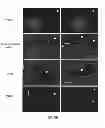 Fig. 02 - Methods and compositions for treating autoimmune diseases