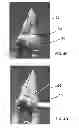 Fig. 06 - Composites for Osteosynthesis
