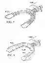 Fig. 05 - Shapeable bite plates