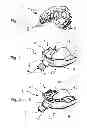Fig. 02 - IMPRESSION TRAY, AND METHOD FOR CAPTURING STRUCTURES, ARRANGEMENTS OR SHAPES, IN PARTICULAR IN THE MOUTH OR HUMAN BODY