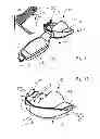 Fig. 06 - IMPRESSION TRAY, AND METHOD FOR CAPTURING STRUCTURES, ARRANGEMENTS OR SHAPES, IN PARTICULAR IN THE MOUTH OR HUMAN BODY