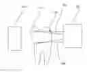 Fig. 01 - Infrared dental imaging