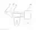 Fig. 08 - Infrared dental imaging