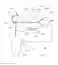Fig. 12 - Infrared dental imaging