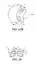 Fig. 33 - Illumination system for dentistry applications
