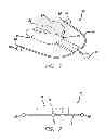 Fig. 02 - Device, system and methods for determining and measuring temporomandibular joint positions and movements