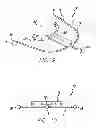Fig. 06 - Device, system and methods for determining and measuring temporomandibular joint positions and movements