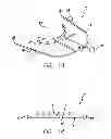 Fig. 08 - Device, system and methods for determining and measuring temporomandibular joint positions and movements