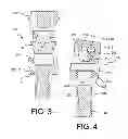 Fig. 04 - Porous implant device for supporting a denture