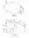 Fig. 02 - Surgical simulator, simulated organs and methods of making same