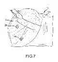 Fig. 06 - Surgical simulator, simulated organs and methods of making same