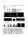Fig. 02 - MECP2E1 gene
