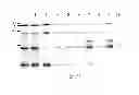 Fig. 22 - Immunogenic proteins of 