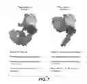 Fig. 09 - COMPOSITION COMPRISING ANTIBODY THAT BINDS TO DOMAIN II OF HER2 AND ACIDIC VARIANTS THEREOF