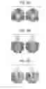 Fig. 08 - Compositions and methods for optimizing drug hydrophobicity and drug delivery to cells