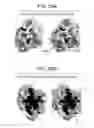 Fig. 28 - Compositions and methods for optimizing drug hydrophobicity and drug delivery to cells