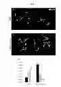 Fig. 06 - Generation of neuronal cells from pluripotent stem cells