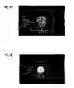 Fig. 07 - Short pulse fiber laser for LTPS crystallization