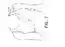 Fig. 07 - Moisture management support garment with a denier differential mechanism