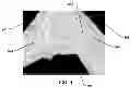 Fig. 04 - Bonded abrasive article and method of grinding