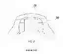 Fig. 03 - TRIPOD JOINT