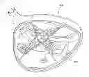 Fig. 01 - Golf club head with removable component
