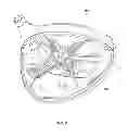 Fig. 04 - Golf club head with removable component