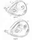 Fig. 10 - Golf club head with removable component