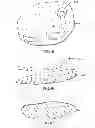 Fig. 28 - Golf club head with removable component