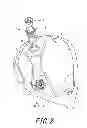 Fig. 03 - Golf club head with removable weight