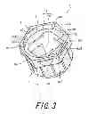 Fig. 04 - Golf club head with removable weight