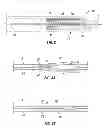 Fig. 03 - Ballistic arrow