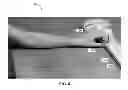 Fig. 09 - Hand exercise device
